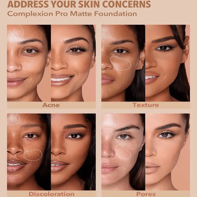 شيجلام كومبليكسين برو LL – كريم أساس مات قابل للتنفس