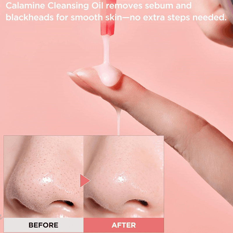 توكوبو زيت تنظيف كالامين للتحكم بالمسام